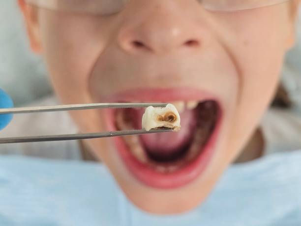 Best Emergency Dentist for Knocked-Out Tooth in Duncansville, PA