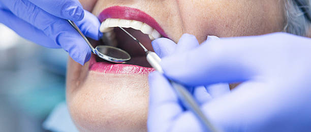 Best Emergency Dentist for Lost Fillings or Crowns in Duncansville, PA